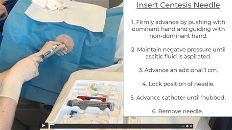 lvp paracentesis